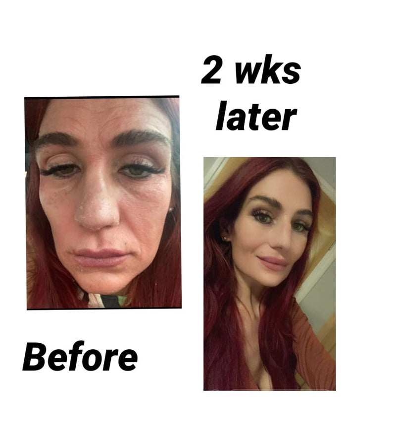Life Changing Transformation.