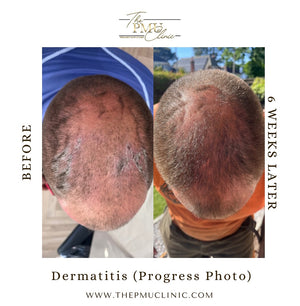 Revive Hair Serum