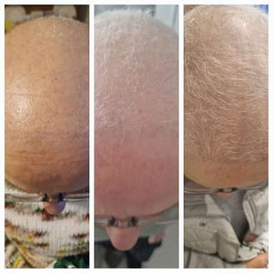 Revive Hair Serum