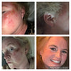 Enhanced Collagen Booster With Hyaluronic Acid & Vitamin C